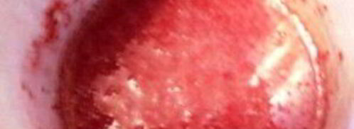 клубничное суфле для торта. Шаг 3