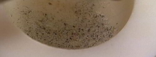 котлеты из индейки с фасолью. Шаг 3