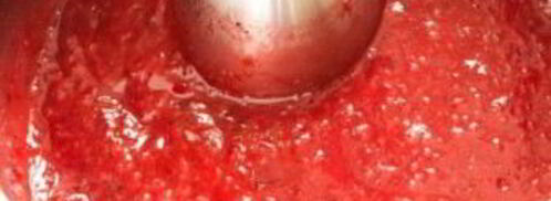 клюквенный конфитюр. Шаг 4